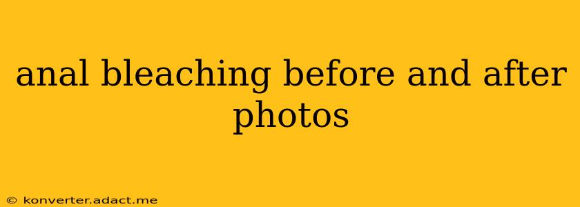 anal bleaching before and after photos