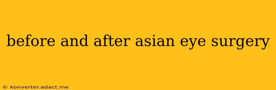 before and after asian eye surgery