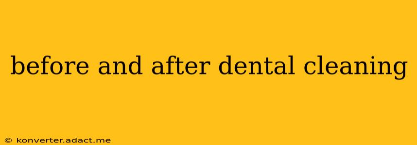 before and after dental cleaning