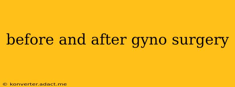 before and after gyno surgery