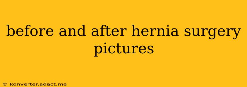 before and after hernia surgery pictures