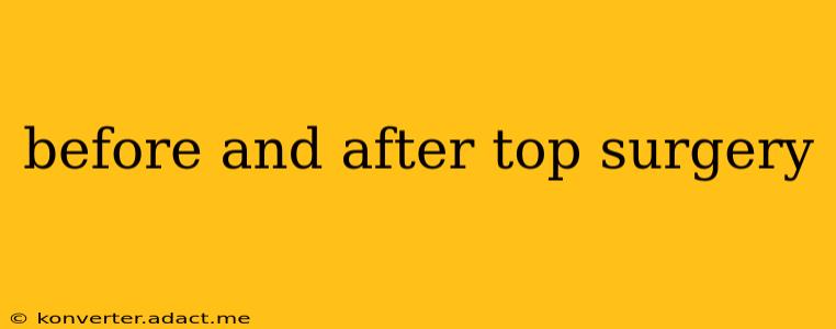 before and after top surgery
