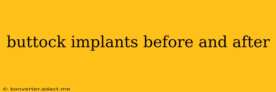 buttock implants before and after