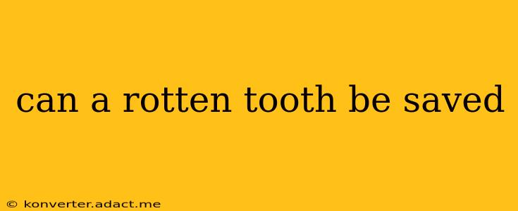 can a rotten tooth be saved