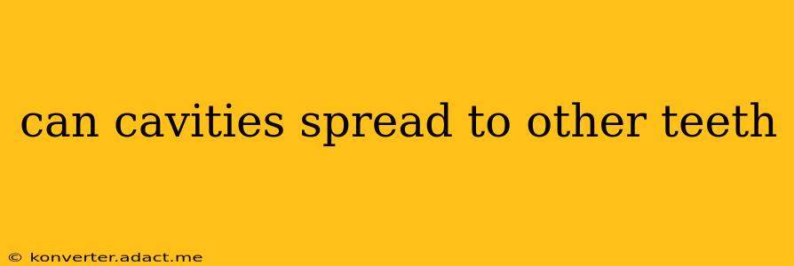 can cavities spread to other teeth