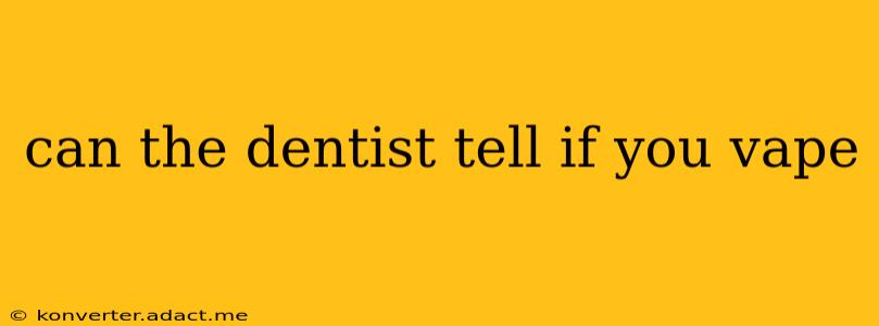 can the dentist tell if you vape