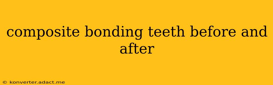 composite bonding teeth before and after