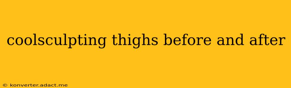 coolsculpting thighs before and after
