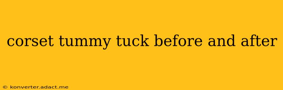 corset tummy tuck before and after