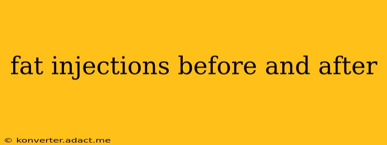 fat injections before and after