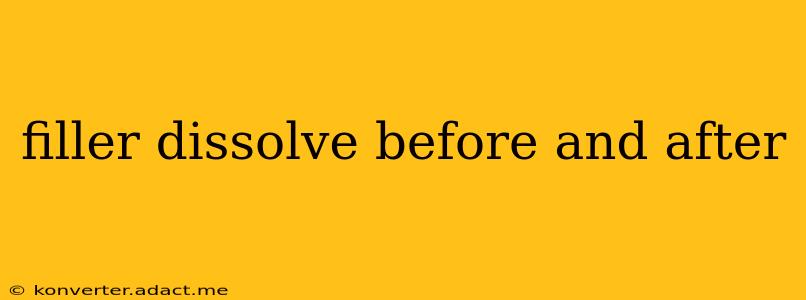 filler dissolve before and after