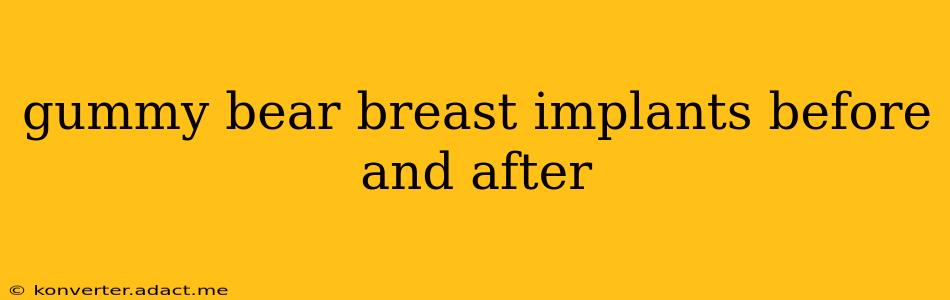 gummy bear breast implants before and after