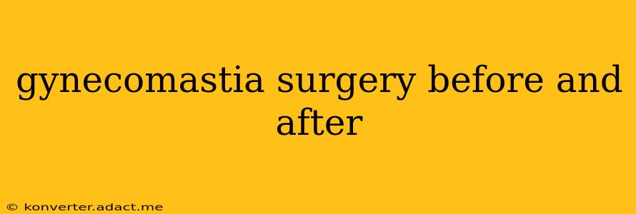 gynecomastia surgery before and after
