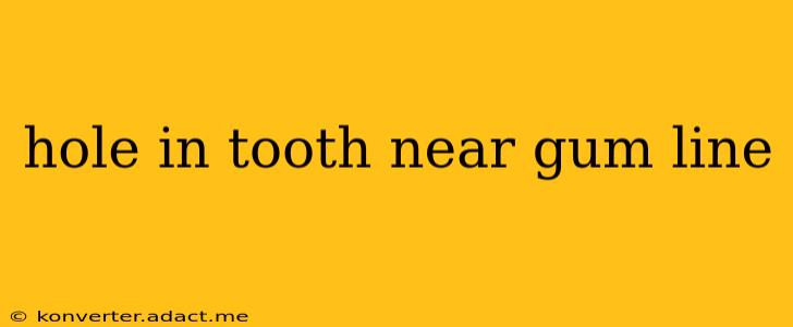 hole in tooth near gum line