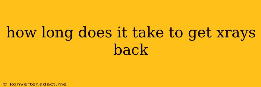 how long does it take to get xrays back