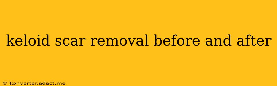 keloid scar removal before and after