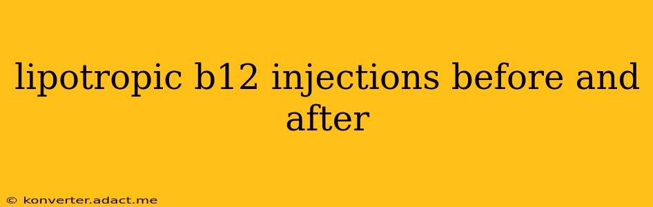 lipotropic b12 injections before and after
