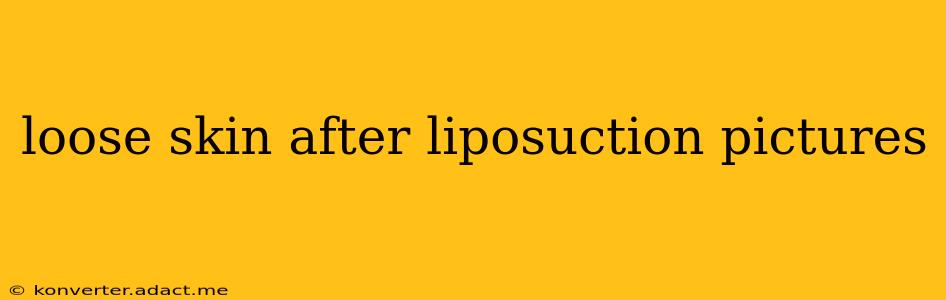 loose skin after liposuction pictures