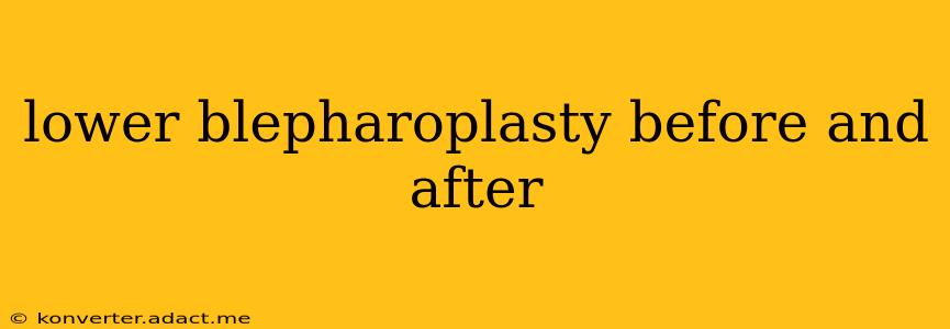 lower blepharoplasty before and after