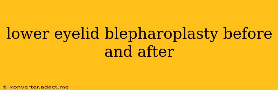 lower eyelid blepharoplasty before and after