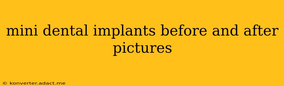 mini dental implants before and after pictures