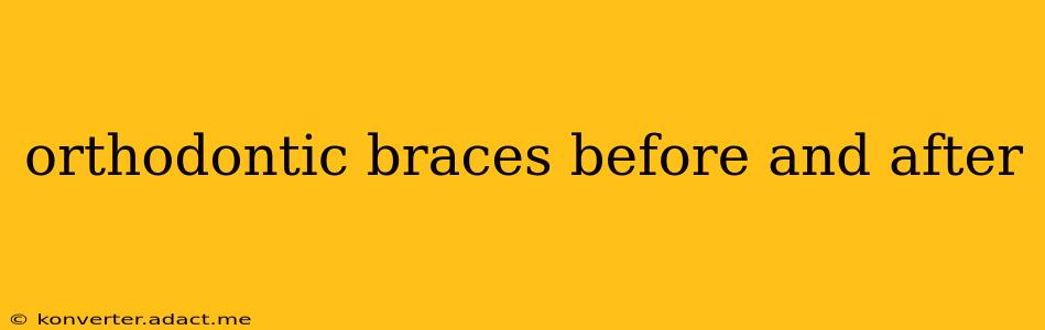 orthodontic braces before and after