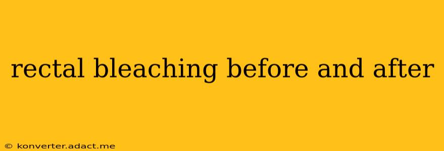 rectal bleaching before and after