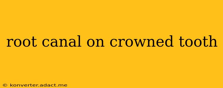 root canal on crowned tooth