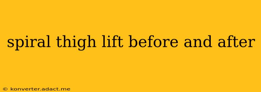 spiral thigh lift before and after