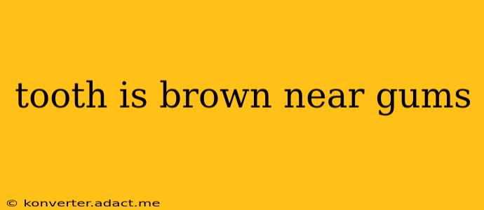 tooth is brown near gums