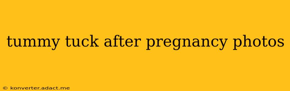tummy tuck after pregnancy photos