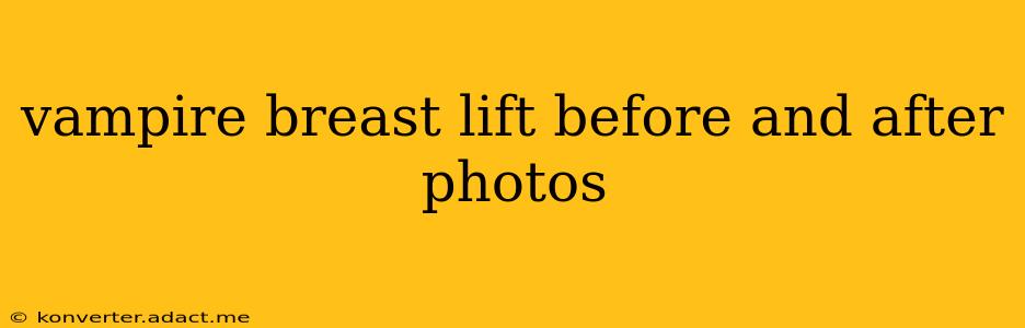 vampire breast lift before and after photos